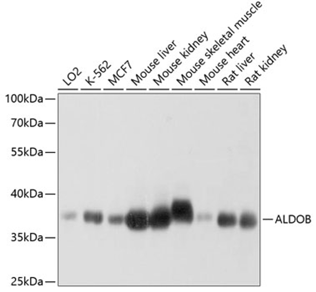 Western blot analysis of extracts of various cell lines, using ALDOB antibody (19-136) at 1:1000 dilution.<br/>Secondary antibody: HRP Goat Anti-Rabbit IgG (H+L) at 1:10000 dilution.<br/>Lysates/proteins: 25ug per lane.<br/>Blocking buffer: 3% nonfat dry milk in TBST.<br/>Detection: ECL Basic Kit.<br/>Exposure time: 1s.