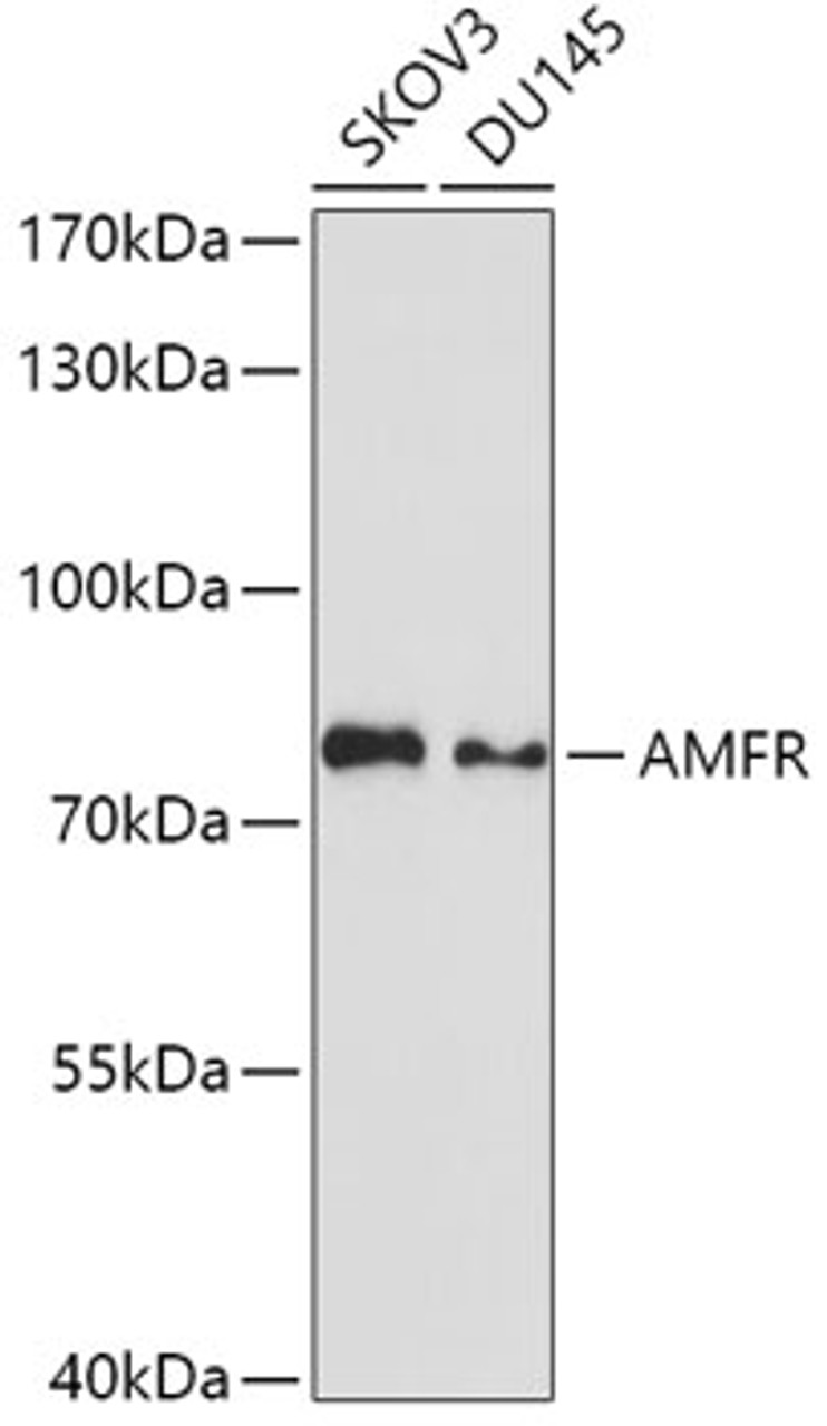 Western blot analysis of extracts of various cell lines, using AMFR antibody (19-138) at 1:1000 dilution.<br/>Secondary antibody: HRP Goat Anti-Rabbit IgG (H+L) at 1:10000 dilution.<br/>Lysates/proteins: 25ug per lane.<br/>Blocking buffer: 3% nonfat dry milk in TBST.<br/>Detection: ECL Basic Kit.<br/>Exposure time: 30s.