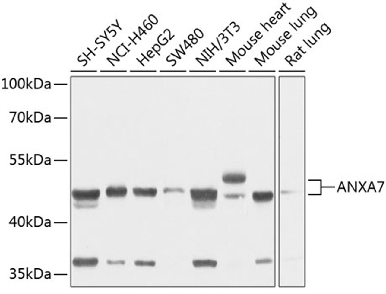 Western blot analysis of extracts of various cell lines, using ANXA7 antibody (19-140) at 1:1000 dilution.<br/>Secondary antibody: HRP Goat Anti-Rabbit IgG (H+L) at 1:10000 dilution.<br/>Lysates/proteins: 25ug per lane.<br/>Blocking buffer: 3% nonfat dry milk in TBST.<br/>Detection: ECL Basic Kit.<br/>Exposure time: 1s.