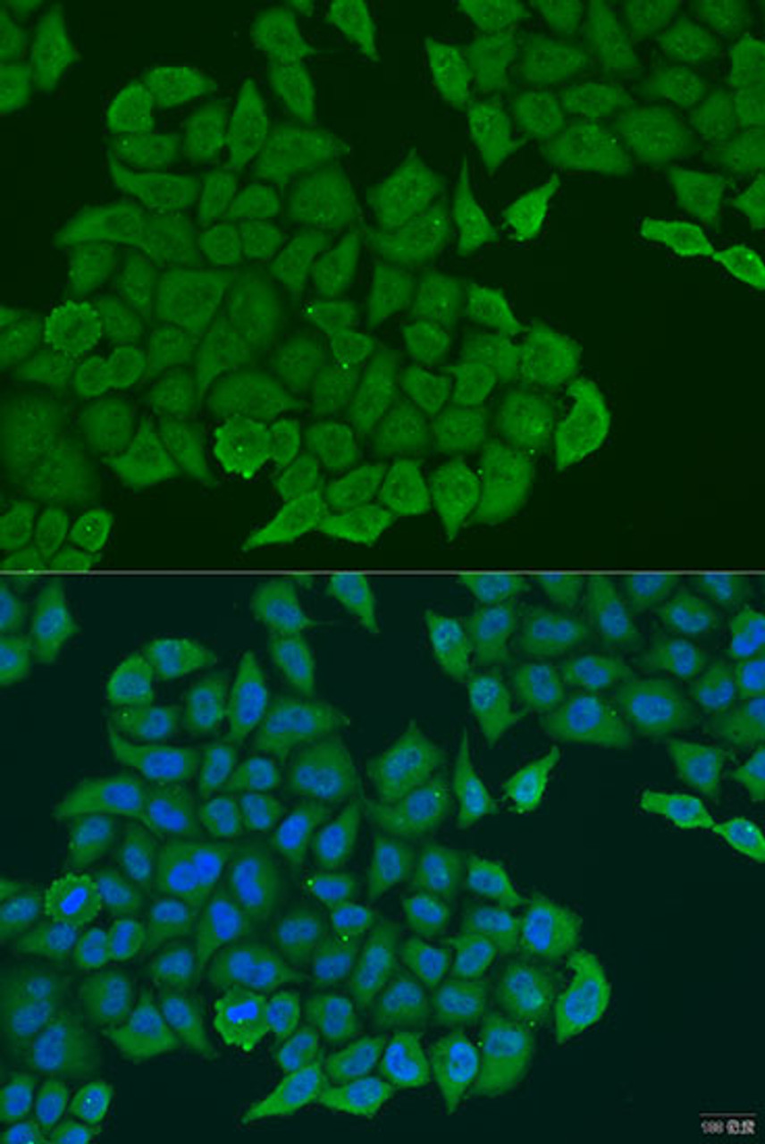 Immunofluorescence analysis of U2OS cells using ANXA7 antibody (19-140) at dilution of 1:100. Blue: DAPI for nuclear staining.