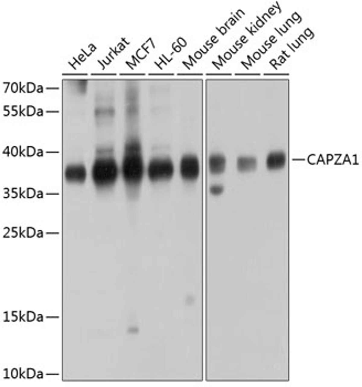 Western blot analysis of extracts of various cell lines, using CAPZA1 antibody (19-155) at 1:1000 dilution.<br/>Secondary antibody: HRP Goat Anti-Rabbit IgG (H+L) at 1:10000 dilution.<br/>Lysates/proteins: 25ug per lane.<br/>Blocking buffer: 3% nonfat dry milk in TBST.<br/>Detection: ECL Enhanced Kit.<br/>Exposure time: 30s.