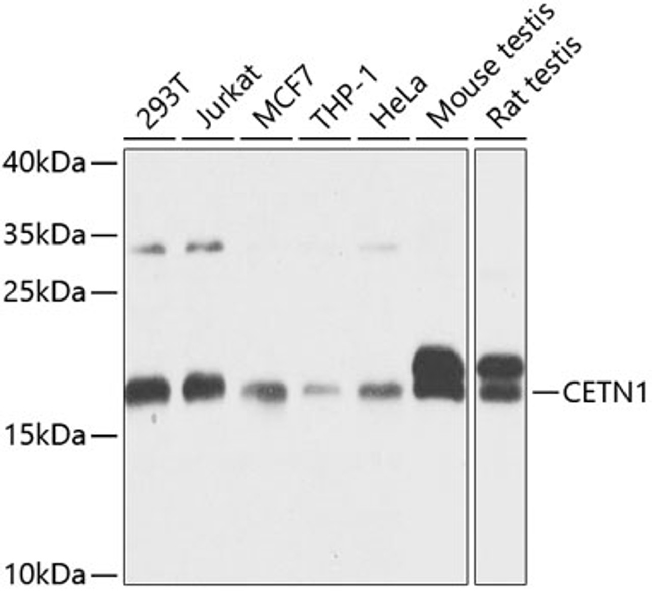 Western blot analysis of extracts of various cell lines, using CETN1 antibody (19-160) at 1:1000 dilution.<br/>Secondary antibody: HRP Goat Anti-Rabbit IgG (H+L) at 1:10000 dilution.<br/>Lysates/proteins: 25ug per lane.<br/>Blocking buffer: 3% nonfat dry milk in TBST.<br/>Detection: ECL Basic Kit.<br/>Exposure time: 10s.