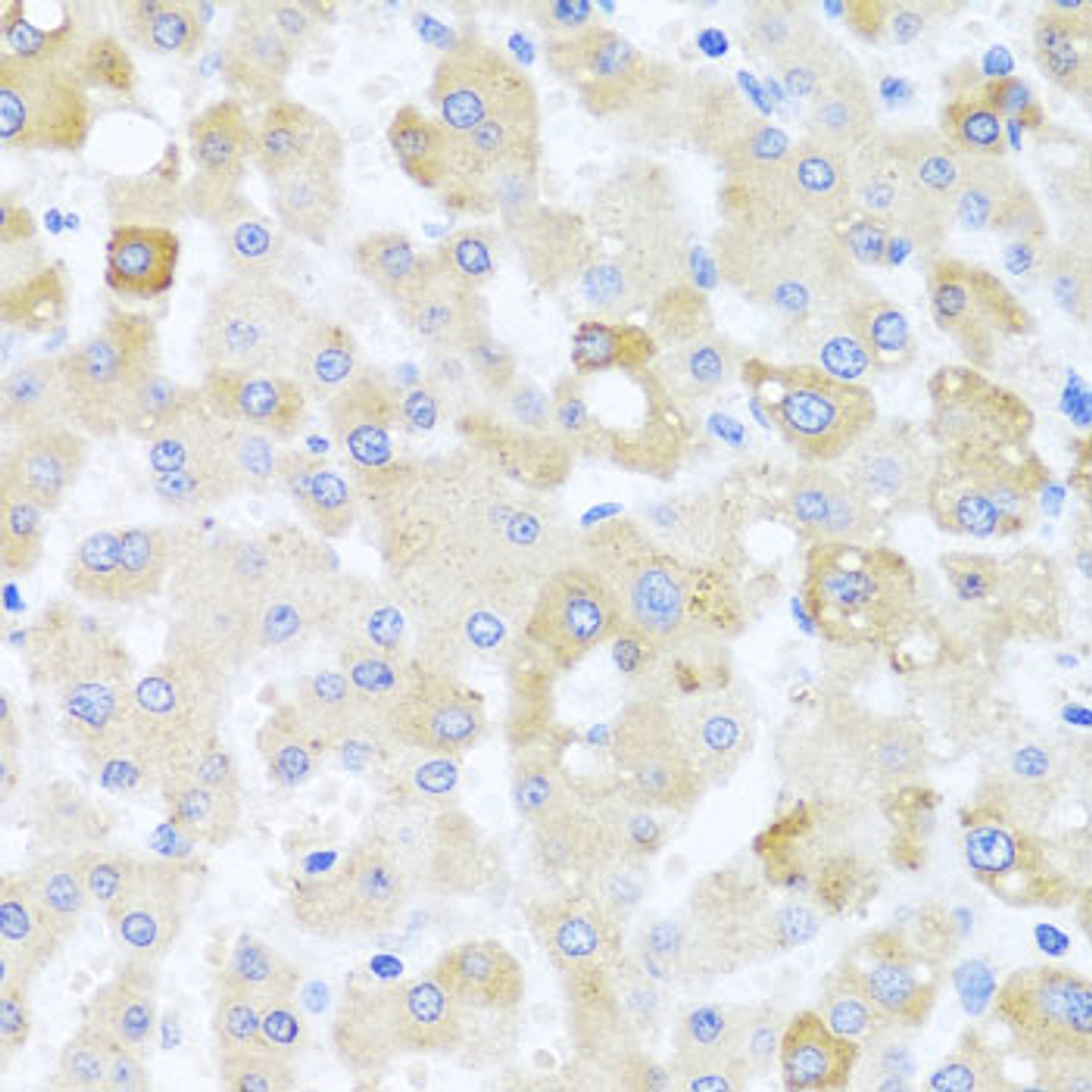 Immunohistochemistry of paraffin-embedded human liver damage using CETN1 antibody (19-160) at dilution of 1:100 (40x lens) .