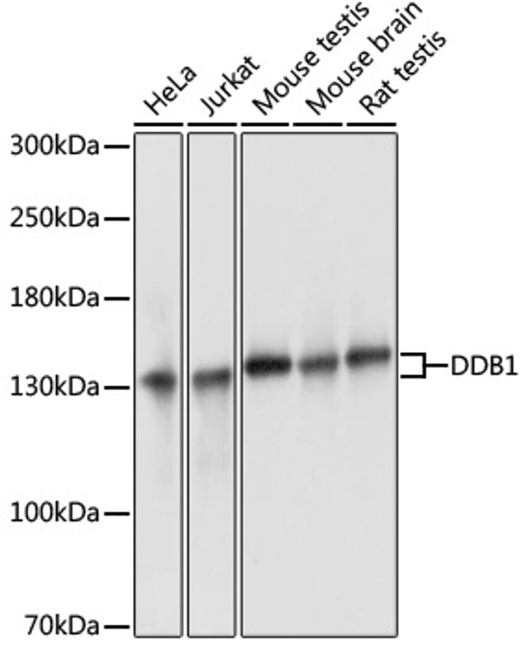 Western blot analysis of extracts of various cell lines, using DDB1 antibody (19-176) at 1:3000 dilution.<br/>Secondary antibody: HRP Goat Anti-Rabbit IgG (H+L) at 1:10000 dilution.<br/>Lysates/proteins: 25ug per lane.<br/>Blocking buffer: 3% nonfat dry milk in TBST.<br/>Detection: ECL Basic Kit.<br/>Exposure time: 1s.