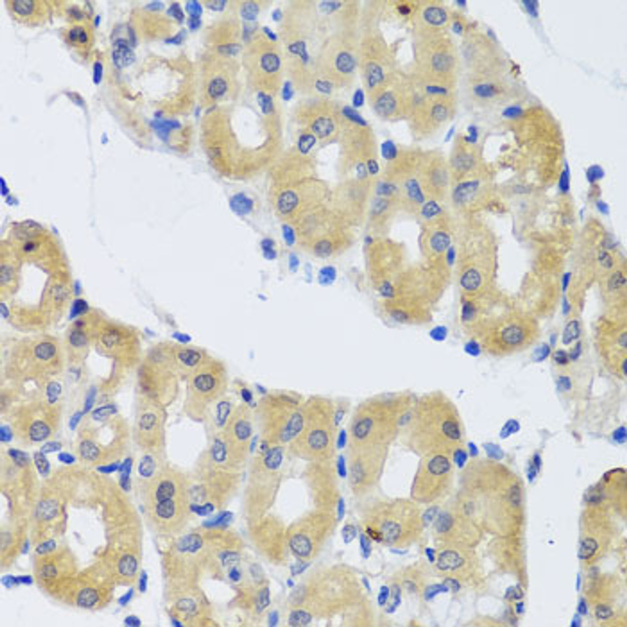 Immunohistochemistry of paraffin-embedded human stomach using DYNC1I1 antibody (19-179) at dilution of 1:100 (40x lens) .