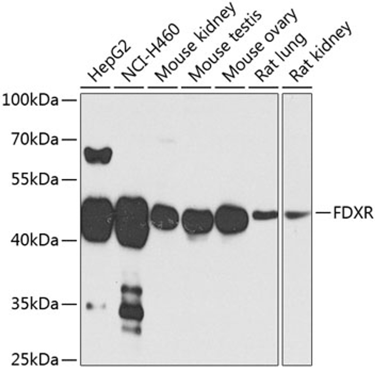 Western blot analysis of extracts of various cell lines, using FDXR antibody (19-187) at 1:1000 dilution._Secondary antibody: HRP Goat Anti-Rabbit IgG (H+L) at 1:10000 dilution._Lysates/proteins: 25ug per lane._Blocking buffer: 3% nonfat dry milk in TBST._Detection: ECL Enhanced Kit._Exposure time: 30s.