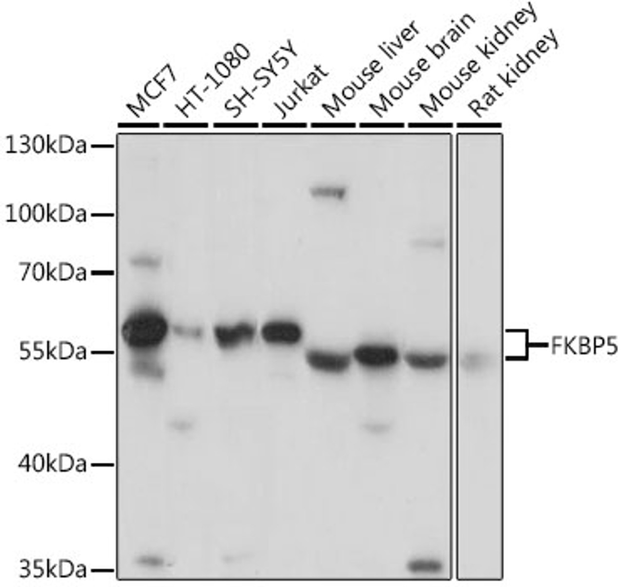 Western blot analysis of extracts of various cell lines, using FKBP5 antibody (19-189) at 1:3000 dilution.<br/>Secondary antibody: HRP Goat Anti-Rabbit IgG (H+L) at 1:10000 dilution.<br/>Lysates/proteins: 25ug per lane.<br/>Blocking buffer: 3% nonfat dry milk in TBST.<br/>Detection: ECL Basic Kit.<br/>Exposure time: 1s.
