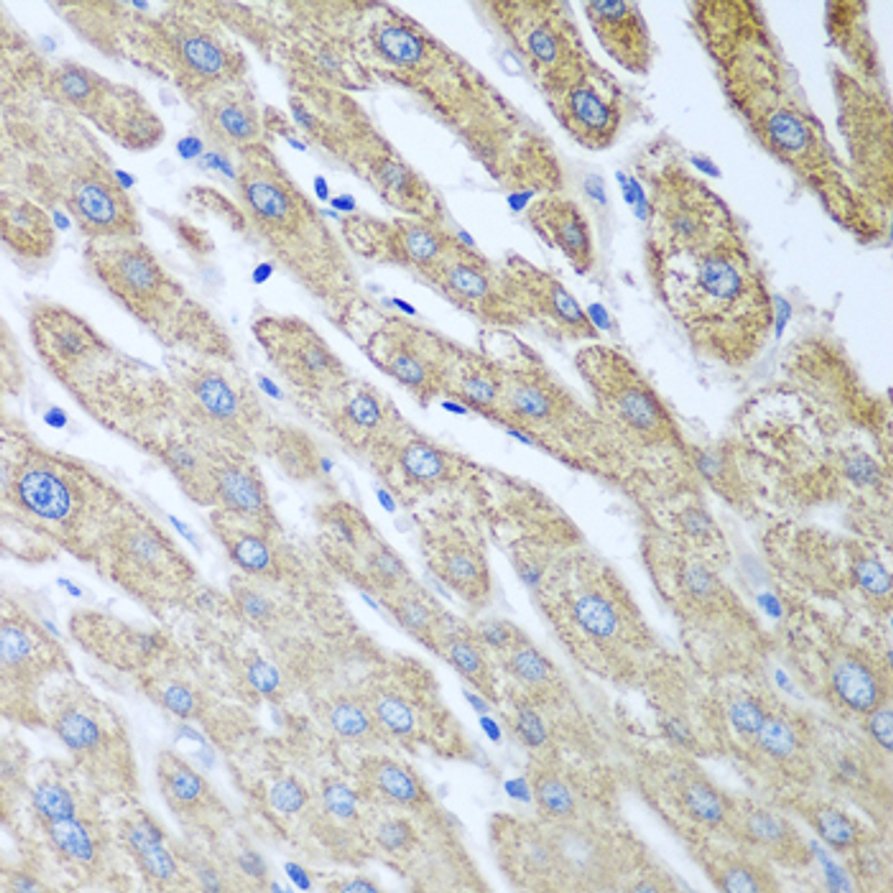 Immunohistochemistry of paraffin-embedded human liver using FUT6 antibody (19-191) at dilution of 1:100 (40x lens) .