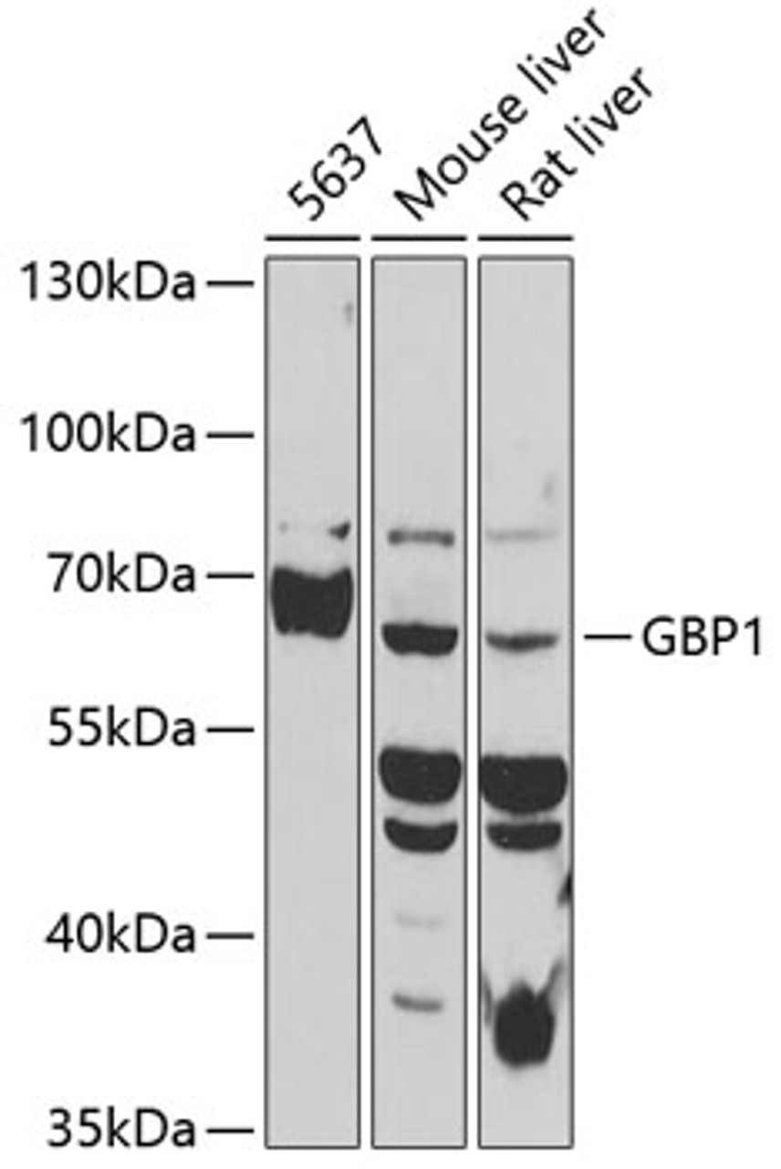 Western blot analysis of extracts of various cell lines, using GBP1 antibody (19-195) at 1:1000 dilution.<br/>Secondary antibody: HRP Goat Anti-Rabbit IgG (H+L) at 1:10000 dilution.<br/>Lysates/proteins: 25ug per lane.<br/>Blocking buffer: 3% nonfat dry milk in TBST.<br/>Detection: ECL Basic Kit.<br/>Exposure time: 10s.