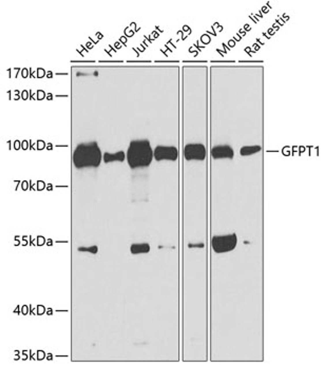 Western blot analysis of extracts of various cell lines, using GFPT1 antibody (19-196) at 1:1000 dilution.<br/>Secondary antibody: HRP Goat Anti-Rabbit IgG (H+L) at 1:10000 dilution.<br/>Lysates/proteins: 25ug per lane.<br/>Blocking buffer: 3% nonfat dry milk in TBST.<br/>Detection: ECL Basic Kit.<br/>Exposure time: 90s.