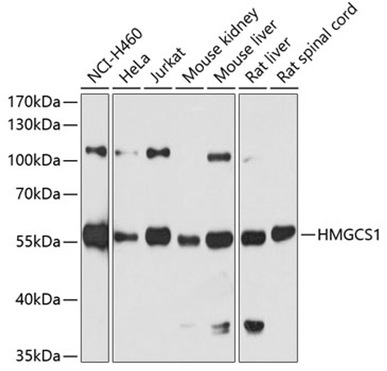 Western blot analysis of extracts of various cell lines, using HMGCS1 antibody (19-209) at 1:7000 dilution.<br/>Secondary antibody: HRP Goat Anti-Rabbit IgG (H+L) at 1:10000 dilution.<br/>Lysates/proteins: 25ug per lane.<br/>Blocking buffer: 3% nonfat dry milk in TBST.<br/>Detection: ECL Basic Kit.<br/>Exposure time: 30s.