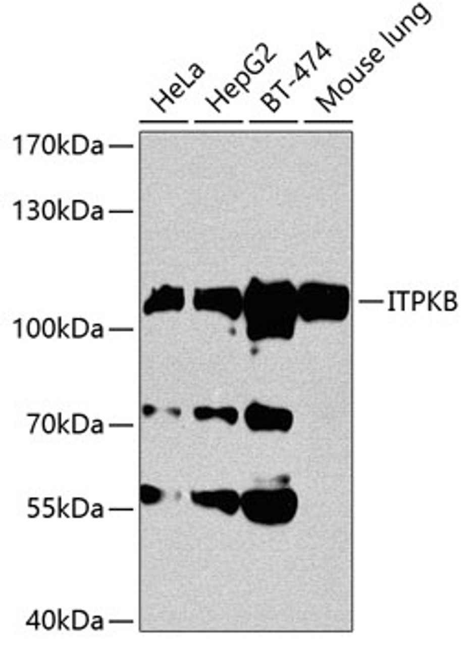 Western blot analysis of extracts of various cell lines, using ITPKB antibody (19-219) at 1:1000 dilution.<br/>Secondary antibody: HRP Goat Anti-Rabbit IgG (H+L) at 1:10000 dilution.<br/>Lysates/proteins: 25ug per lane.<br/>Blocking buffer: 3% nonfat dry milk in TBST.<br/>Detection: ECL Basic Kit.<br/>Exposure time: 60s.