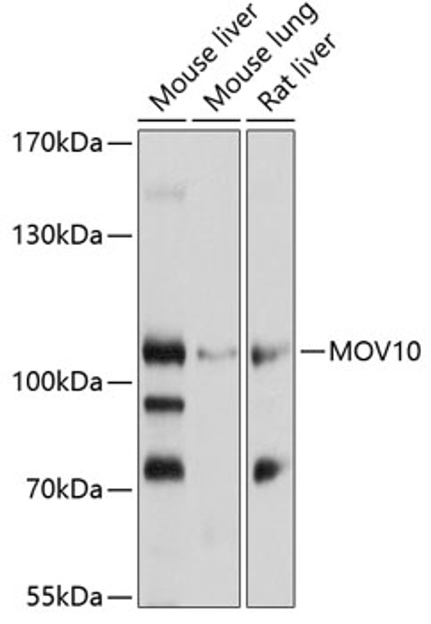 Western blot analysis of extracts of various cell lines, using MOV10 antibody (19-231) at 1:1000 dilution.<br/>Secondary antibody: HRP Goat Anti-Rabbit IgG (H+L) at 1:10000 dilution.<br/>Lysates/proteins: 25ug per lane.<br/>Blocking buffer: 3% nonfat dry milk in TBST.<br/>Detection: ECL Basic Kit.<br/>Exposure time: 30s.