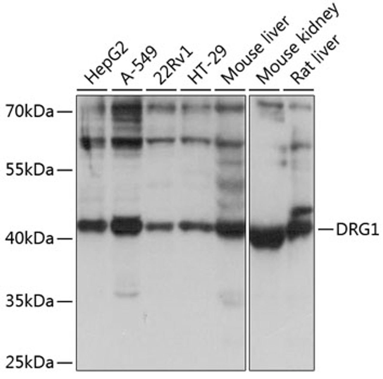Western blot analysis of extracts of various cell lines, using DRG1 antibody (19-239) at 1:1000 dilution.<br/>Secondary antibody: HRP Goat Anti-Rabbit IgG (H+L) at 1:10000 dilution.<br/>Lysates/proteins: 25ug per lane.<br/>Blocking buffer: 3% nonfat dry milk in TBST.<br/>Detection: ECL Basic Kit.<br/>Exposure time: 5s.