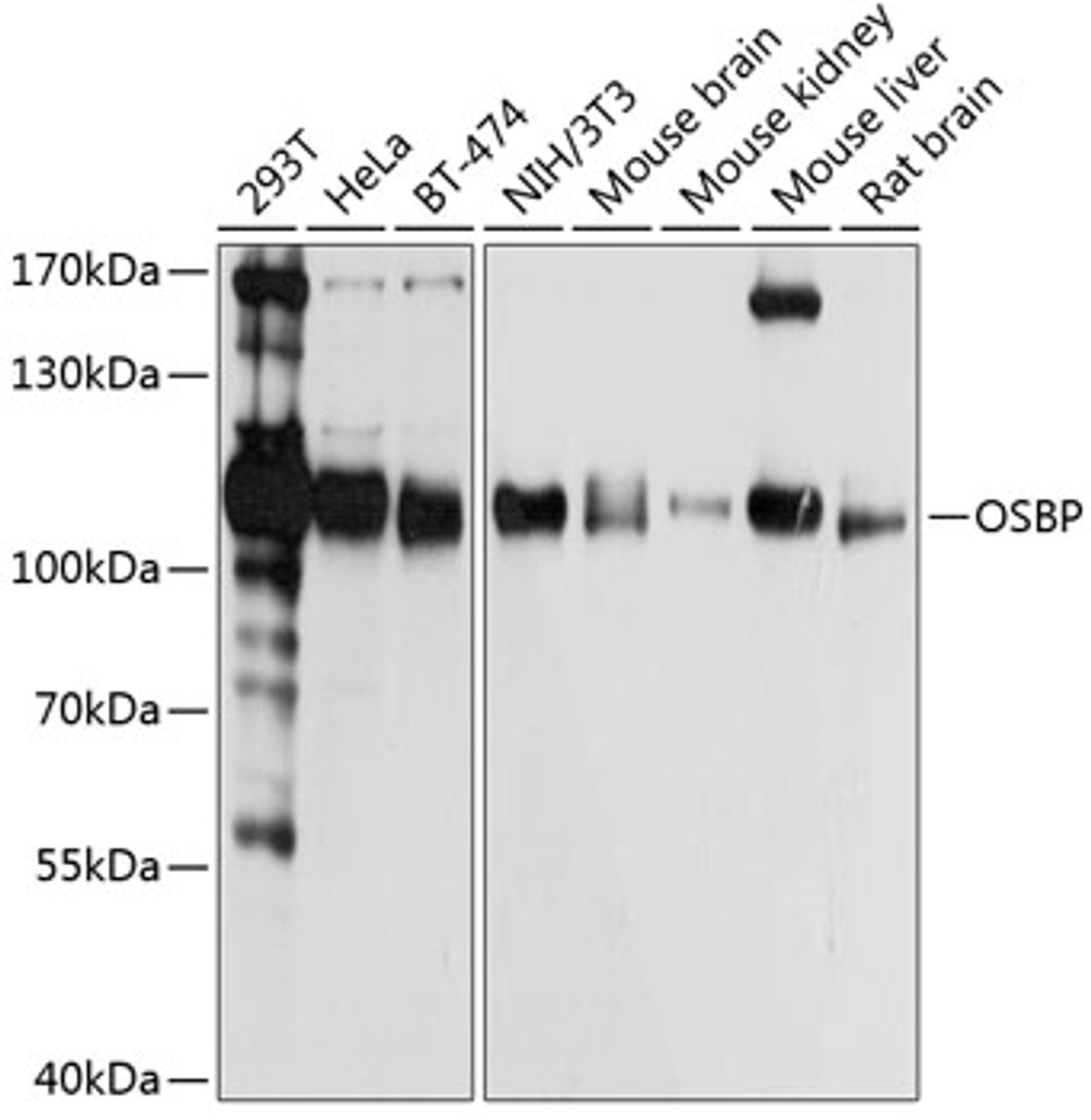Western blot analysis of extracts of various cell lines, using OSBP antibody (19-241) at 1:1000 dilution.<br/>Secondary antibody: HRP Goat Anti-Rabbit IgG (H+L) at 1:10000 dilution.<br/>Lysates/proteins: 25ug per lane.<br/>Blocking buffer: 3% nonfat dry milk in TBST.<br/>Detection: ECL Basic Kit.<br/>Exposure time: 1s.