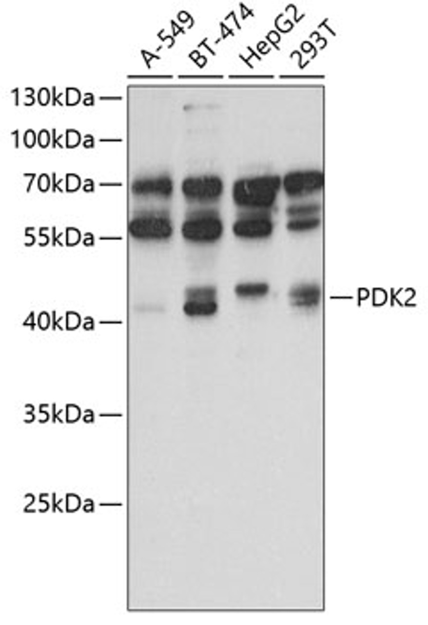 Western blot analysis of extracts of various cell lines, using PDK2 antibody (19-245) at 1:1000 dilution.<br/>Secondary antibody: HRP Goat Anti-Rabbit IgG (H+L) at 1:10000 dilution.<br/>Lysates/proteins: 25ug per lane.<br/>Blocking buffer: 3% nonfat dry milk in TBST.<br/>Detection: ECL Basic Kit.<br/>Exposure time: 90s.