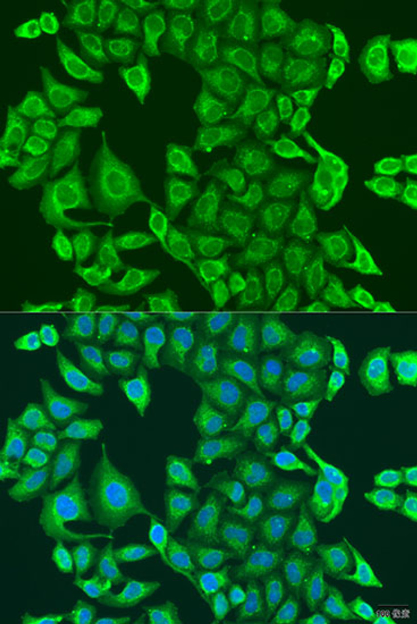 Immunofluorescence analysis of U2OS cells using PDK2 antibody (19-245) at dilution of 1:100. Blue: DAPI for nuclear staining.