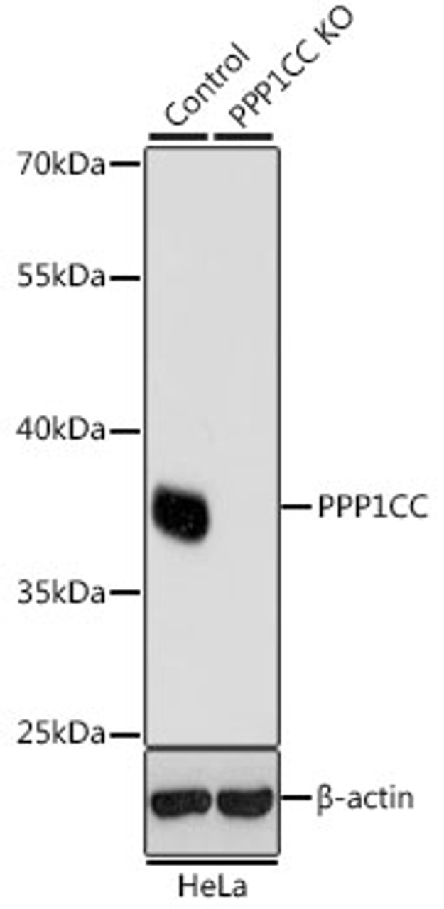 Western blot analysis of extracts from normal (control) and PPP1CC knockout (KO) HeLa cells, using PPP1CC antibody (19-252) at 1:1000 dilution.<br/>Secondary antibody: HRP Goat Anti-Rabbit IgG (H+L) at 1:10000 dilution.<br/>Lysates/proteins: 25ug per lane.<br/>Blocking buffer: 3% nonfat dry milk in TBST.<br/>Detection: ECL Basic Kit.<br/>Exposure time: 1s.