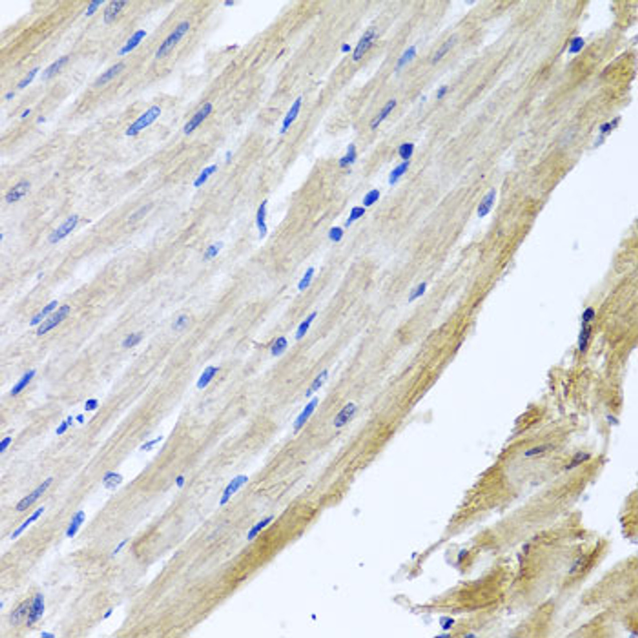 Immunohistochemistry of paraffin-embedded rat heart using PRPH antibody (19-256) at dilution of 1:100 (40x lens) .