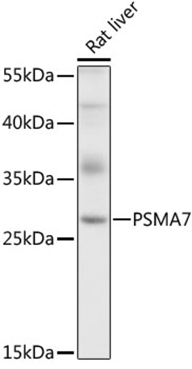 Western blot analysis of extracts of rat liver, using PSMA7 antibody (19-258) at 1:1000 dilution.<br/>Secondary antibody: HRP Goat Anti-Rabbit IgG (H+L) at 1:10000 dilution.<br/>Lysates/proteins: 25ug per lane.<br/>Blocking buffer: 3% nonfat dry milk in TBST.<br/>Detection: ECL Basic Kit.<br/>Exposure time: 5s.