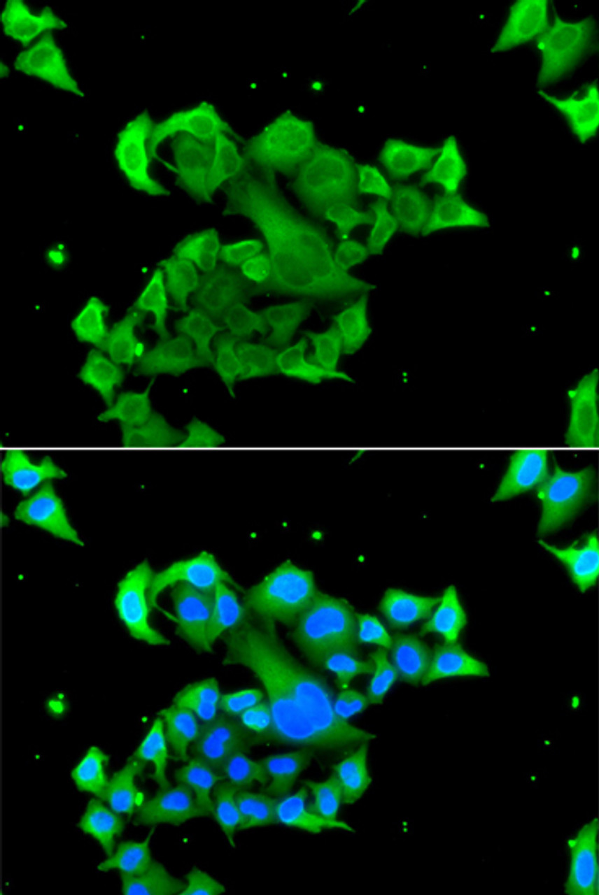 Immunofluorescence analysis of A549 cells using RAD51D antibody (19-263) . Blue: DAPI for nuclear staining.