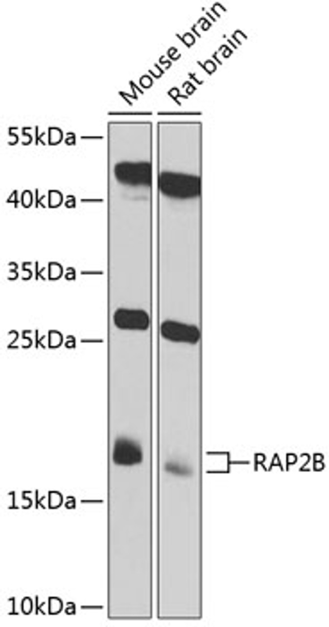 Western blot analysis of extracts of various cell lines, using RAP2B antibody (19-266) at 1:1000 dilution.<br/>Secondary antibody: HRP Goat Anti-Rabbit IgG (H+L) at 1:10000 dilution.<br/>Lysates/proteins: 25ug per lane.<br/>Blocking buffer: 3% nonfat dry milk in TBST.<br/>Detection: ECL Basic Kit.<br/>Exposure time: 60s.