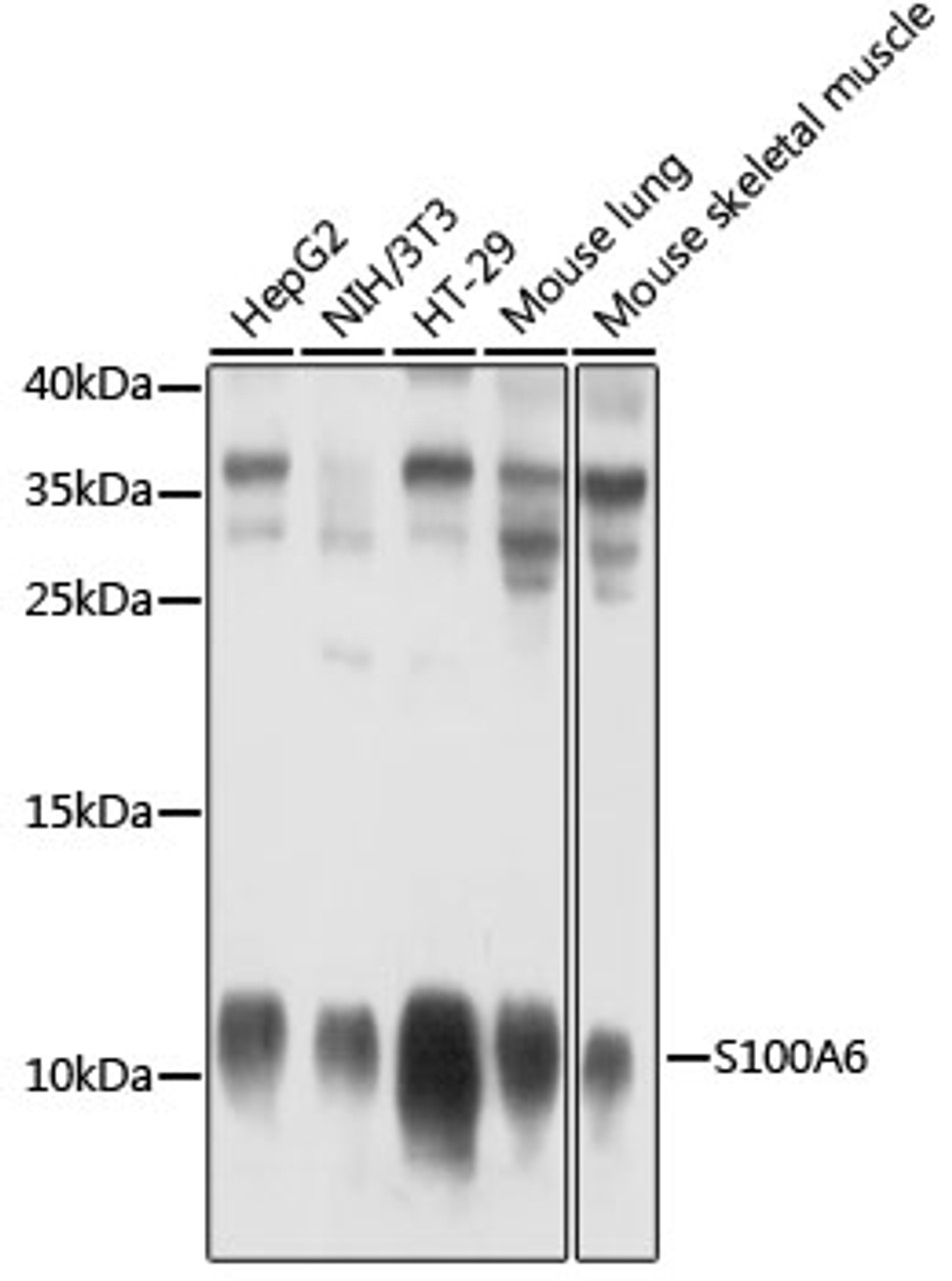 Western blot analysis of extracts of various cell lines, using S100A6 antibody (19-278) at 1:1000 dilution.<br/>Secondary antibody: HRP Goat Anti-Rabbit IgG (H+L) at 1:10000 dilution.<br/>Lysates/proteins: 25ug per lane.<br/>Blocking buffer: 3% nonfat dry milk in TBST.<br/>Detection: ECL Basic Kit.<br/>Exposure time: 10s.