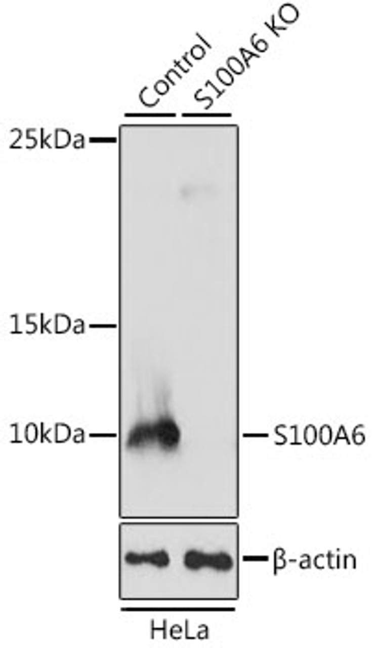 Western blot analysis of extracts from normal (control) and S100A6 knockout (KO) HeLa cells, using S100A6 antibody (19-278) at 1:1000 dilution.<br/>Secondary antibody: HRP Goat Anti-Rabbit IgG (H+L) at 1:10000 dilution.<br/>Lysates/proteins: 25ug per lane.<br/>Blocking buffer: 3% nonfat dry milk in TBST.<br/>Detection: ECL Basic Kit.<br/>Exposure time: 60s.