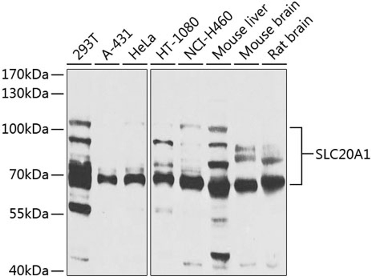 Western blot analysis of extracts of various cell lines, using SLC20A1 antibody (19-284) at 1:1000 dilution.<br/>Secondary antibody: HRP Goat Anti-Rabbit IgG (H+L) at 1:10000 dilution.<br/>Lysates/proteins: 25ug per lane.<br/>Blocking buffer: 3% nonfat dry milk in TBST.<br/>Detection: ECL Basic Kit.<br/>Exposure time: 15s.