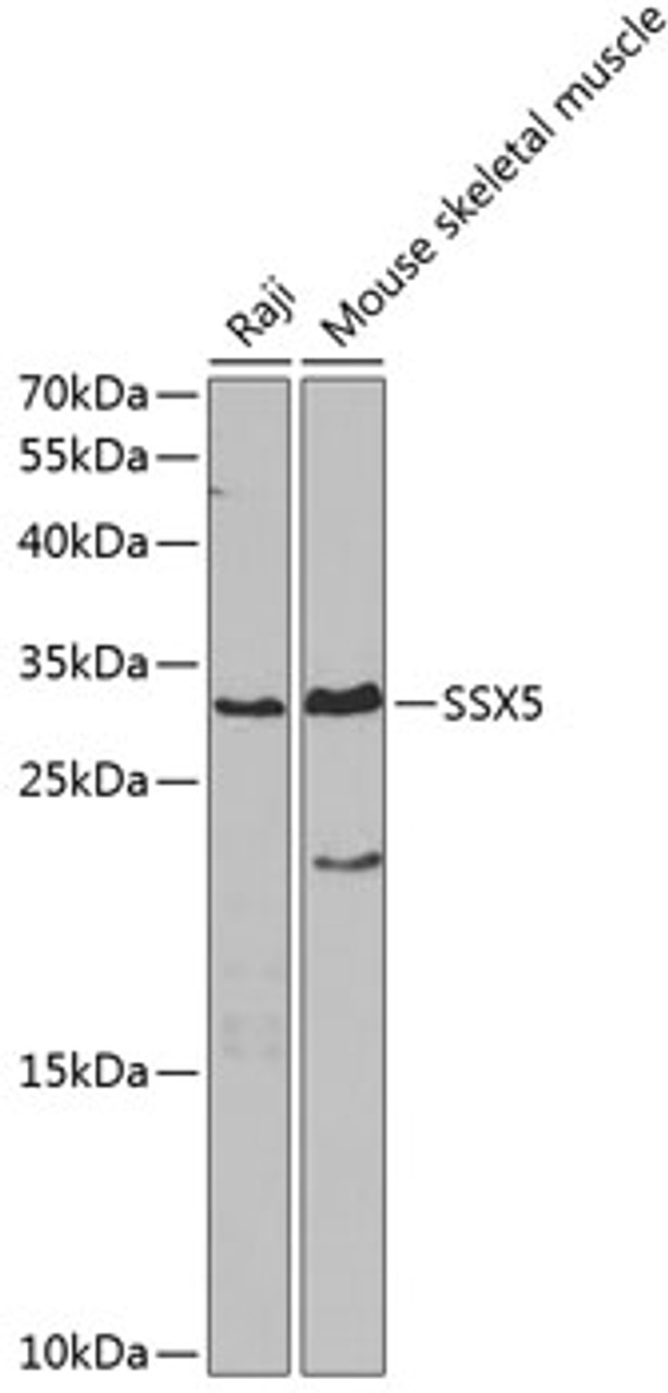 Western blot analysis of extracts of various cell lines, using SSX5 antibody (19-288) at 1:1000 dilution.<br/>Secondary antibody: HRP Goat Anti-Rabbit IgG (H+L) at 1:10000 dilution.<br/>Lysates/proteins: 25ug per lane.<br/>Blocking buffer: 3% nonfat dry milk in TBST.<br/>Detection: ECL Basic Kit.<br/>Exposure time: 90s.