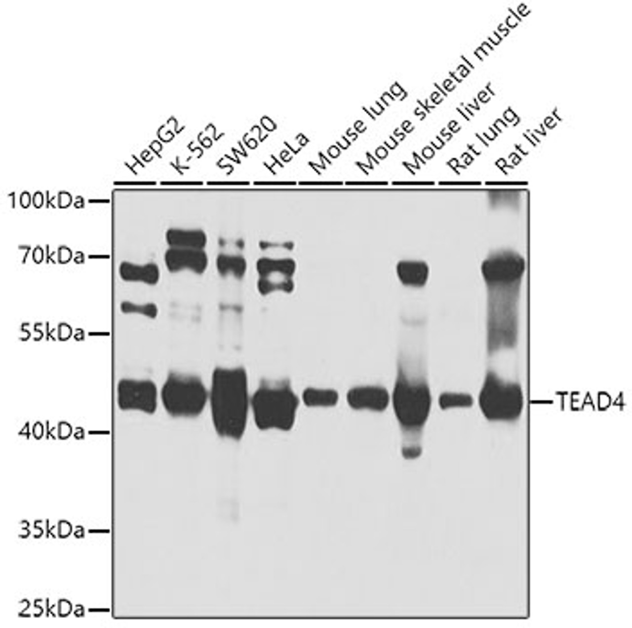 Western blot analysis of extracts of various cell lines, using TEAD4 antibody (19-293) at 1:1000 dilution.<br/>Secondary antibody: HRP Goat Anti-Rabbit IgG (H+L) at 1:10000 dilution.<br/>Lysates/proteins: 25ug per lane.<br/>Blocking buffer: 3% nonfat dry milk in TBST.<br/>Detection: ECL Basic Kit.<br/>Exposure time: 10s.