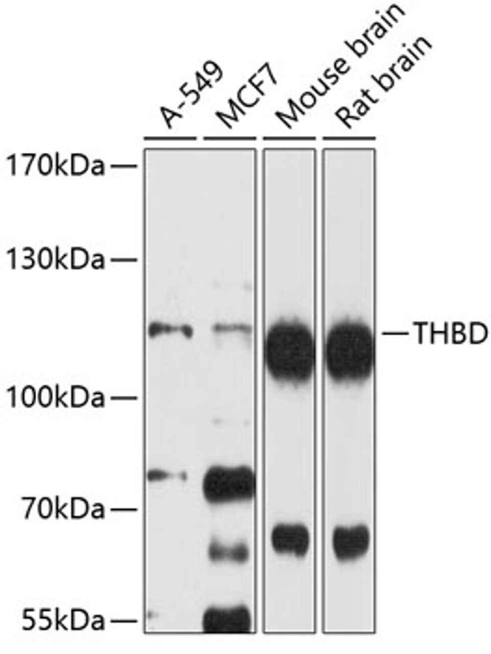 Western blot analysis of extracts of various cell lines, using THBD antibody (19-294) at 1:1000 dilution.<br/>Secondary antibody: HRP Goat Anti-Rabbit IgG (H+L) at 1:10000 dilution.<br/>Lysates/proteins: 25ug per lane.<br/>Blocking buffer: 3% nonfat dry milk in TBST.<br/>Detection: ECL Basic Kit.<br/>Exposure time: 90s.