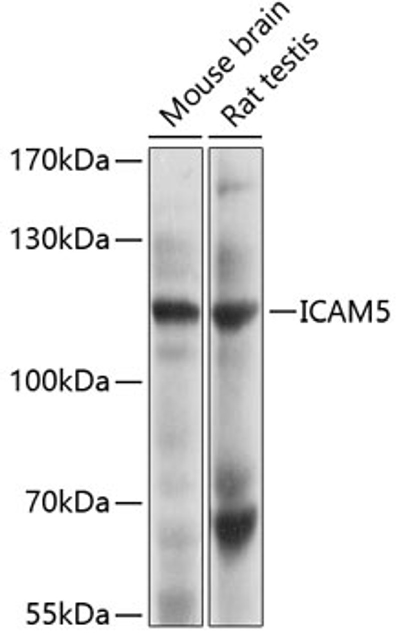 Western blot analysis of extracts of various cell lines, using ICAM5 Antibody (19-295) at 1:1000 dilution.<br/>Secondary antibody: HRP Goat Anti-Rabbit IgG (H+L) at 1:10000 dilution.<br/>Lysates/proteins: 25ug per lane.<br/>Blocking buffer: 3% nonfat dry milk in TBST.<br/>Detection: ECL Basic Kit.<br/>Exposure time: 30s.