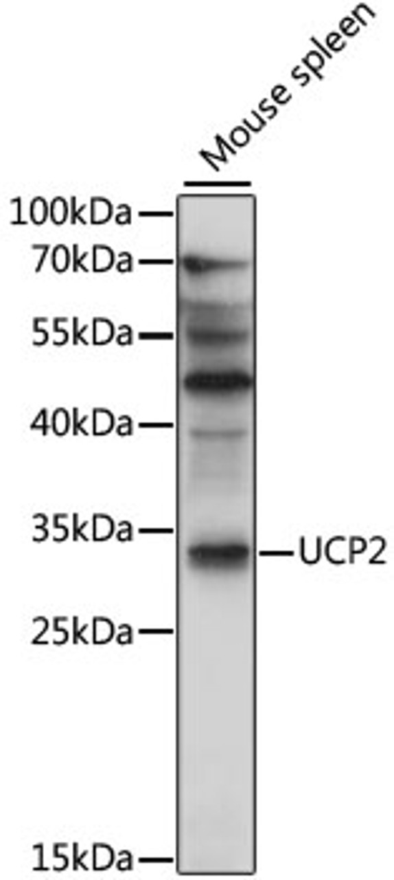 Western blot analysis of extracts of mouse spleen, using UCP2 antibody (19-299) at 1:1000 dilution.<br/>Secondary antibody: HRP Goat Anti-Rabbit IgG (H+L) at 1:10000 dilution.<br/>Lysates/proteins: 25ug per lane.<br/>Blocking buffer: 3% nonfat dry milk in TBST.<br/>Detection: ECL Basic Kit.<br/>Exposure time: 10s.