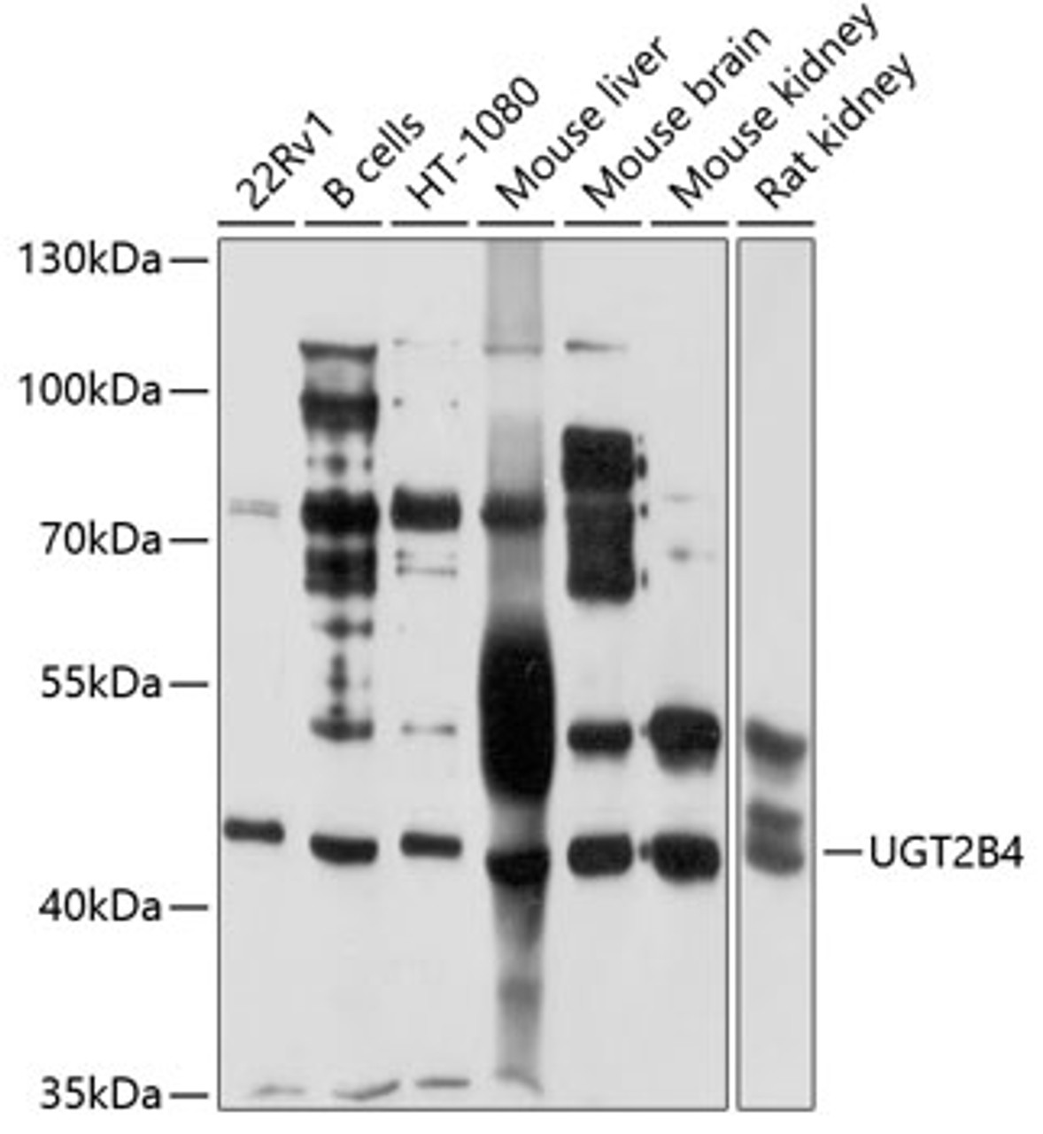 Western blot analysis of extracts of various cell lines, using UGT2B4 antibody (19-300) at 1:1000 dilution.<br/>Secondary antibody: HRP Goat Anti-Rabbit IgG (H+L) at 1:10000 dilution.<br/>Lysates/proteins: 25ug per lane.<br/>Blocking buffer: 3% nonfat dry milk in TBST.<br/>Detection: ECL Basic Kit.<br/>Exposure time: 10s.