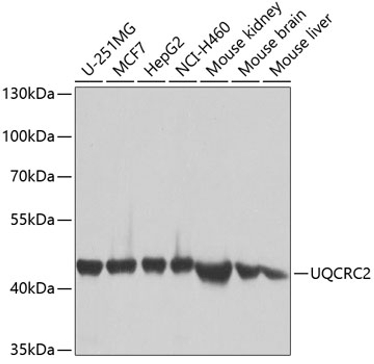 Western blot analysis of extracts of various cell lines, using UQCRC2 antibody (19-301) at 1:1000 dilution.<br/>Secondary antibody: HRP Goat Anti-Rabbit IgG (H+L) at 1:10000 dilution.<br/>Lysates/proteins: 25ug per lane.<br/>Blocking buffer: 3% nonfat dry milk in TBST.<br/>Detection: ECL Basic Kit.<br/>Exposure time: 1s.