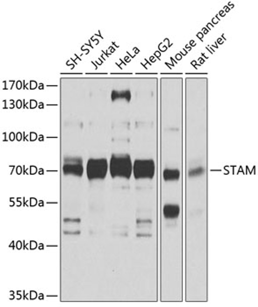 Western blot analysis of extracts of various cell lines, using STAM antibody (19-305) at 1:1000 dilution.<br/>Secondary antibody: HRP Goat Anti-Rabbit IgG (H+L) at 1:10000 dilution.<br/>Lysates/proteins: 25ug per lane.<br/>Blocking buffer: 3% nonfat dry milk in TBST.<br/>Detection: ECL Basic Kit.<br/>Exposure time: 15s.