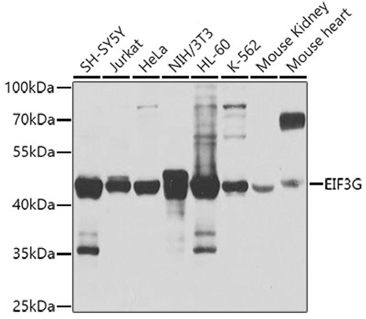 Western blot analysis of extracts of various cell lines, using EIF3G antibody (19-316) at 1:1000 dilution.<br/>Secondary antibody: HRP Goat Anti-Rabbit IgG (H+L) at 1:10000 dilution.<br/>Lysates/proteins: 25ug per lane.<br/>Blocking buffer: 3% nonfat dry milk in TBST.<br/>Detection: ECL Basic Kit.<br/>Exposure time: 1s.