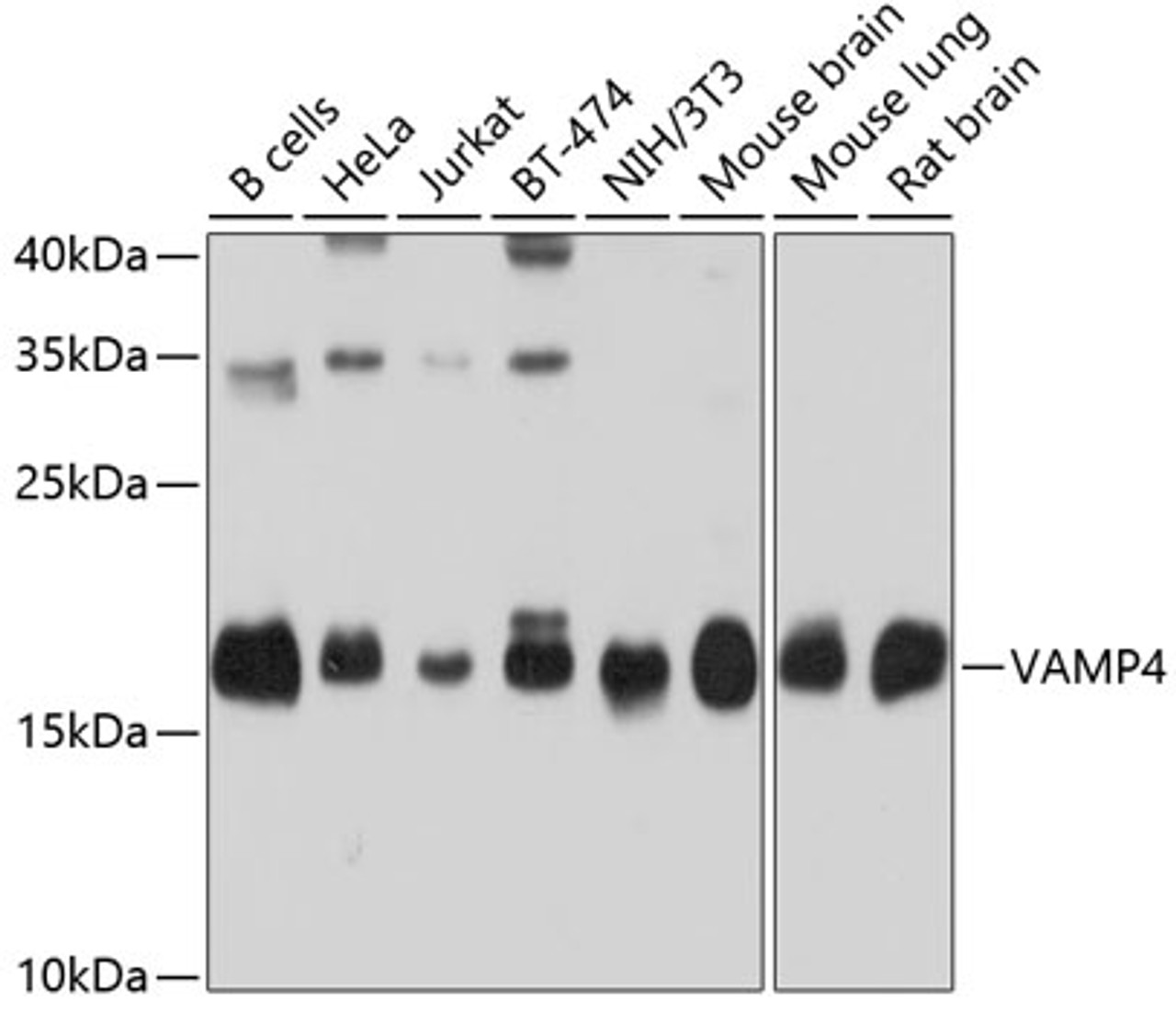 Western blot analysis of extracts of various cell lines, using VAMP4 antibody (19-317) at 1:1000 dilution.<br/>Secondary antibody: HRP Goat Anti-Rabbit IgG (H+L) at 1:10000 dilution.<br/>Lysates/proteins: 25ug per lane.<br/>Blocking buffer: 3% nonfat dry milk in TBST.<br/>Detection: ECL Basic Kit.<br/>Exposure time: 10s.