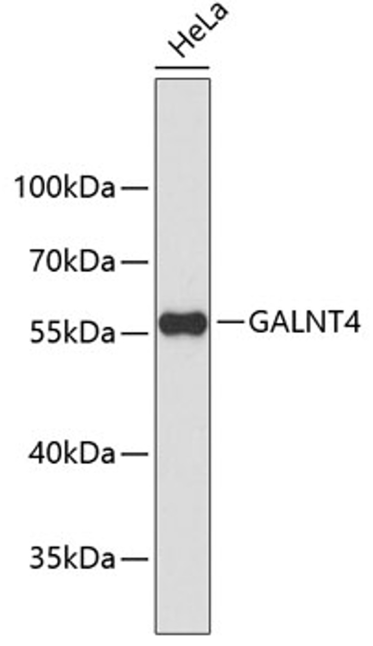 Western blot analysis of extracts of HeLa cells, using GALNT4 antibody (19-318) .<br/>Secondary antibody: HRP Goat Anti-Rabbit IgG (H+L) at 1:10000 dilution.<br/>Lysates/proteins: 25ug per lane.<br/>Blocking buffer: 3% nonfat dry milk in TBST.