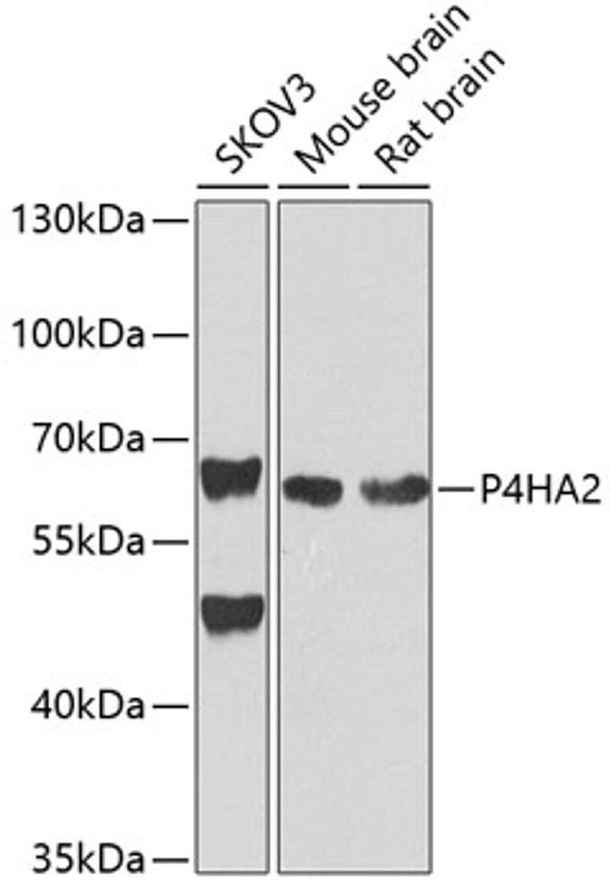 Western blot analysis of extracts of various cell lines, using P4HA2 antibody (19-321) at 1:1000 dilution.<br/>Secondary antibody: HRP Goat Anti-Rabbit IgG (H+L) at 1:10000 dilution.<br/>Lysates/proteins: 25ug per lane.<br/>Blocking buffer: 3% nonfat dry milk in TBST.<br/>Detection: ECL Basic Kit.<br/>Exposure time: 30s.
