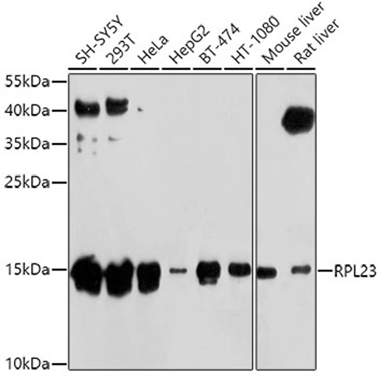 Western blot analysis of extracts of various cell lines, using RPL23 antibody (19-331) at 1:1000 dilution.<br/>Secondary antibody: HRP Goat Anti-Rabbit IgG (H+L) at 1:10000 dilution.<br/>Lysates/proteins: 25ug per lane.<br/>Blocking buffer: 3% nonfat dry milk in TBST.<br/>Detection: ECL Basic Kit.<br/>Exposure time: 5s.