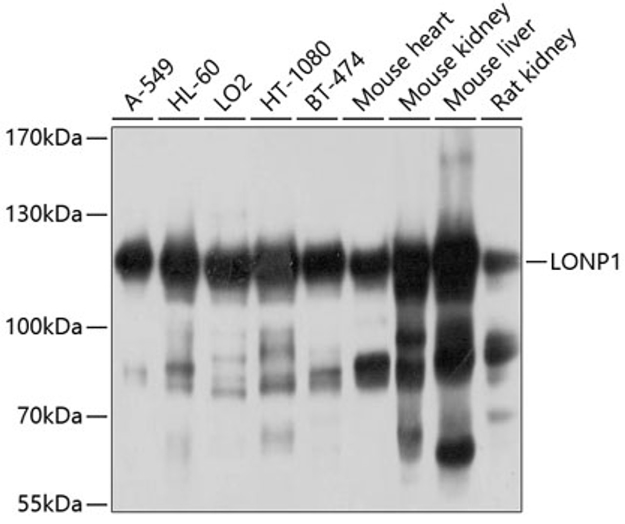 Western blot analysis of extracts of various cell lines, using LONP1 antibody (19-332) at 1:1000 dilution.<br/>Secondary antibody: HRP Goat Anti-Rabbit IgG (H+L) at 1:10000 dilution.<br/>Lysates/proteins: 25ug per lane.<br/>Blocking buffer: 3% nonfat dry milk in TBST.<br/>Detection: ECL Basic Kit.<br/>Exposure time: 5s.