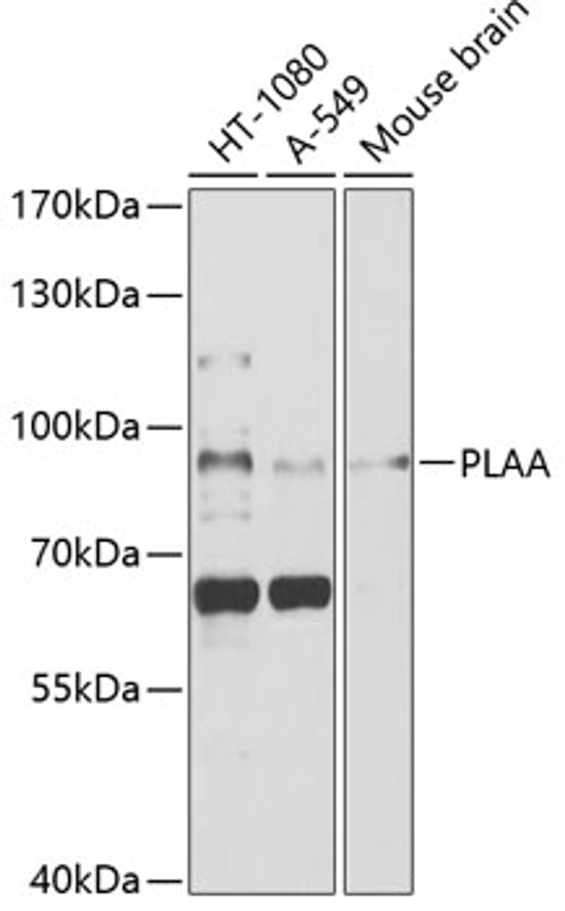 Western blot analysis of extracts of various cell lines, using PLAA antibody (19-333) at 1:1000 dilution.<br/>Secondary antibody: HRP Goat Anti-Rabbit IgG (H+L) at 1:10000 dilution.<br/>Lysates/proteins: 25ug per lane.<br/>Blocking buffer: 3% nonfat dry milk in TBST.<br/>Detection: ECL Basic Kit.<br/>Exposure time: 10s.
