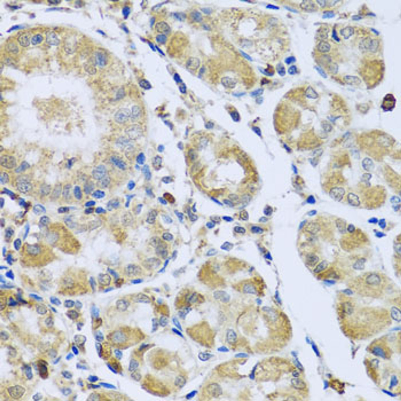 Immunohistochemistry of paraffin-embedded human stomach using PMPCB antibody (19-337) at dilution of 1:100 (40x lens) .