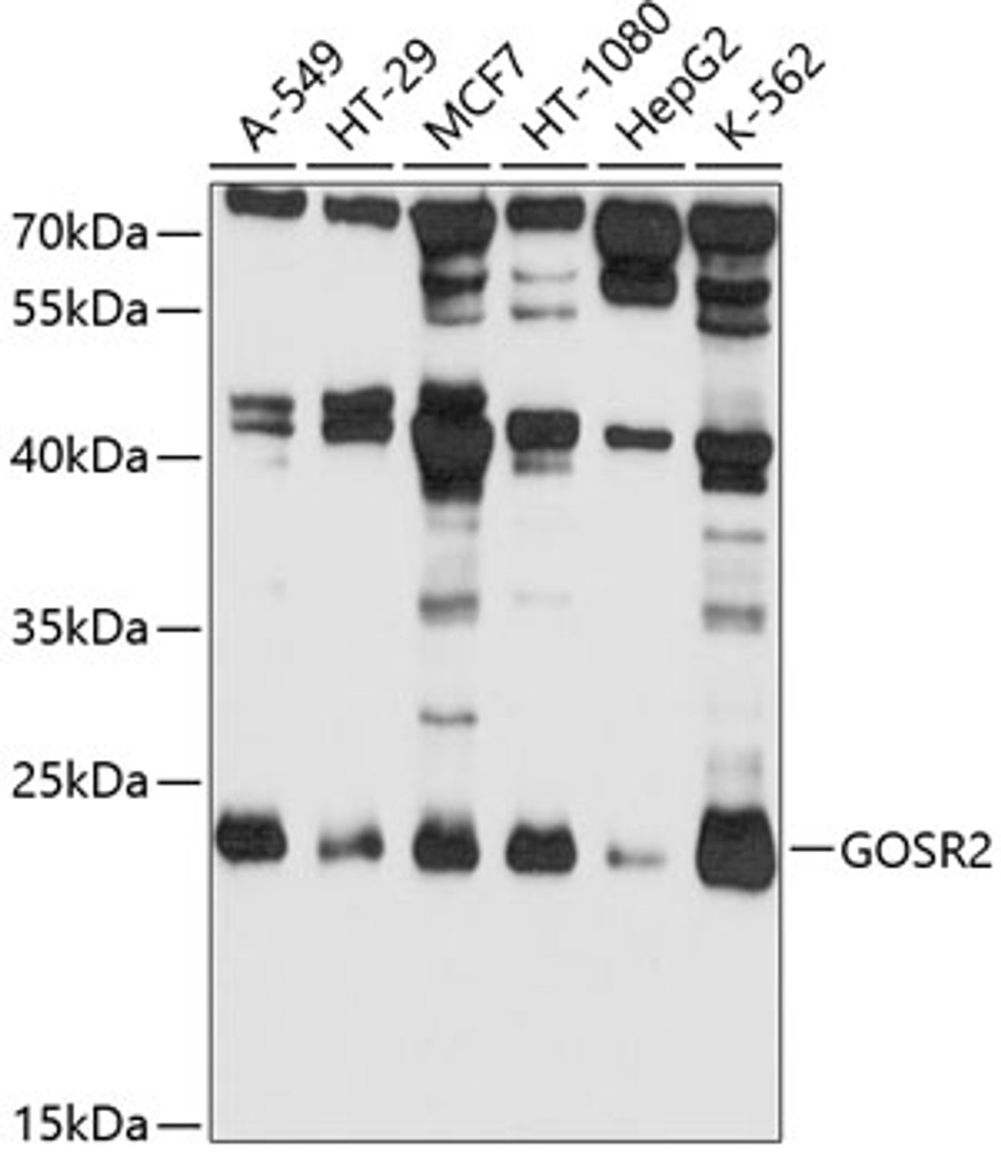 Western blot analysis of extracts of various cell lines, using GOSR2 antibody (19-341) at 1:1000 dilution.<br/>Secondary antibody: HRP Goat Anti-Rabbit IgG (H+L) at 1:10000 dilution.<br/>Lysates/proteins: 25ug per lane.<br/>Blocking buffer: 3% nonfat dry milk in TBST.<br/>Detection: ECL Basic Kit.<br/>Exposure time: 10s.
