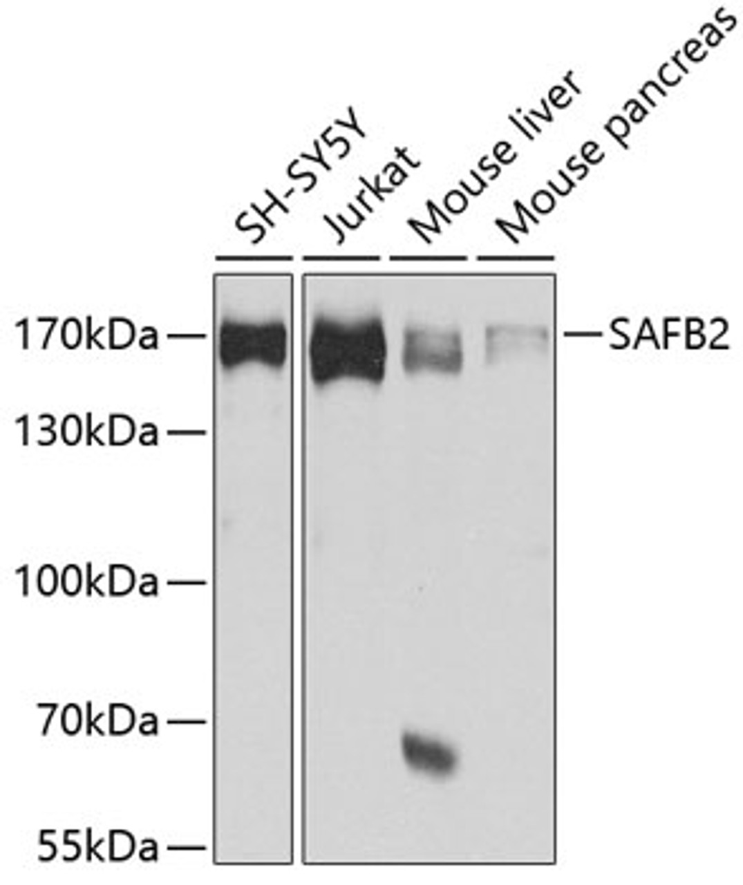 Western blot analysis of extracts of various cell lines, using SAFB2 antibody (19-344) at 1:1000 dilution.<br/>Secondary antibody: HRP Goat Anti-Rabbit IgG (H+L) at 1:10000 dilution.<br/>Lysates/proteins: 25ug per lane.<br/>Blocking buffer: 3% nonfat dry milk in TBST.<br/>Detection: ECL Basic Kit.<br/>Exposure time: 30s.