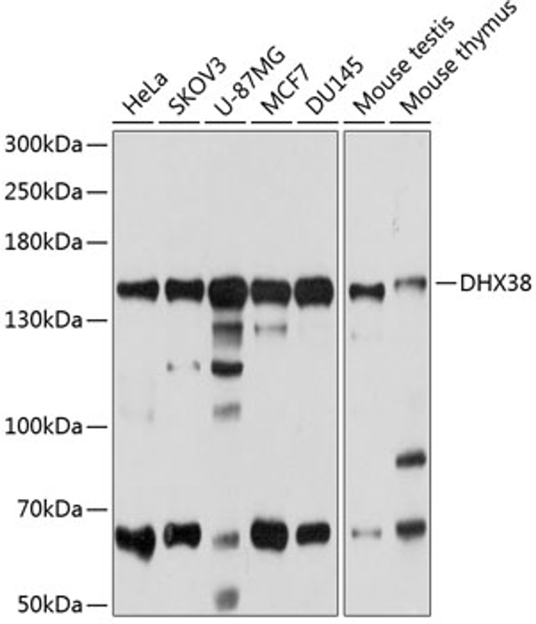 Western blot analysis of extracts of various cell lines, using DHX38 antibody (19-349) at 1:1000 dilution.<br/>Secondary antibody: HRP Goat Anti-Rabbit IgG (H+L) at 1:10000 dilution.<br/>Lysates/proteins: 25ug per lane.<br/>Blocking buffer: 3% nonfat dry milk in TBST.<br/>Detection: ECL Basic Kit.<br/>Exposure time: 20s.