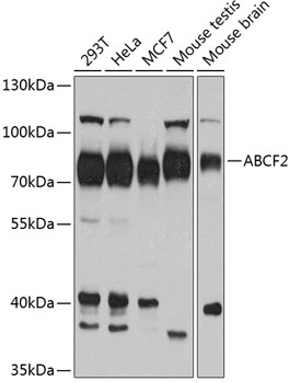 Western blot analysis of extracts of various cell lines, using ABCF2 antibody (19-352) at 1:1000 dilution.<br/>Secondary antibody: HRP Goat Anti-Rabbit IgG (H+L) at 1:10000 dilution.<br/>Lysates/proteins: 25ug per lane.<br/>Blocking buffer: 3% nonfat dry milk in TBST.<br/>Detection: ECL Basic Kit.<br/>Exposure time: 60s.