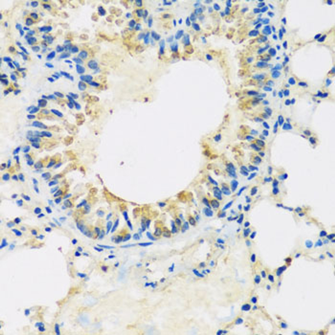 Immunohistochemistry of paraffin-embedded mouse lung using ABCF2 antibody (19-352) at dilution of 1:100 (40x lens) .